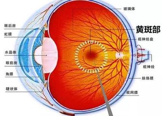 黃斑變性是怎么回事？黃斑變性的方法？