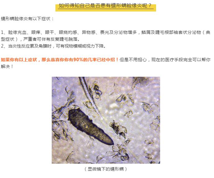 小心！你的眼睛可能正在被螨蟲(chóng)肆虐